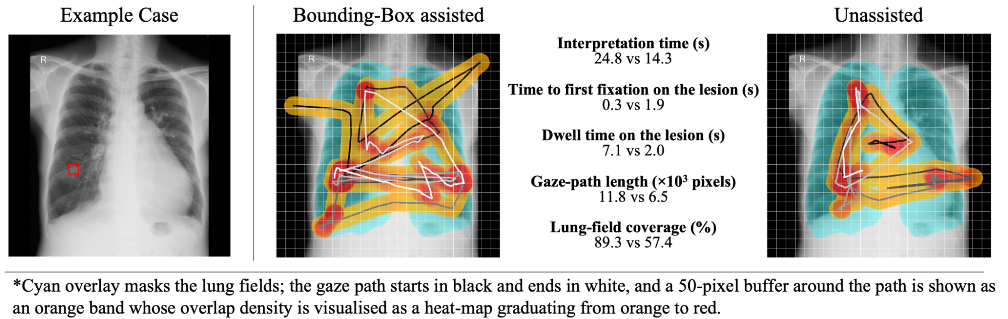 視線情報の可視化